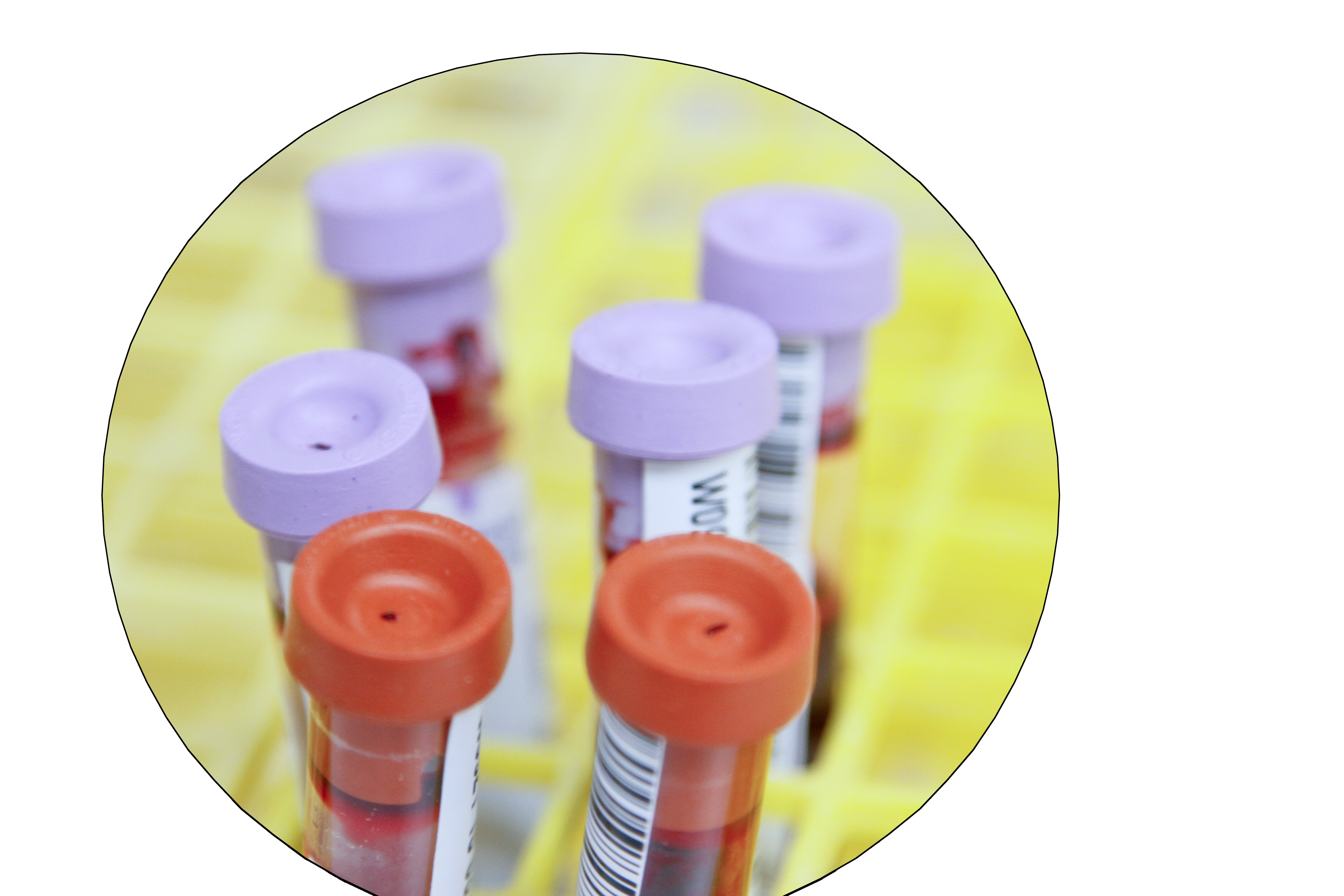 REALENDRAMAB - cells